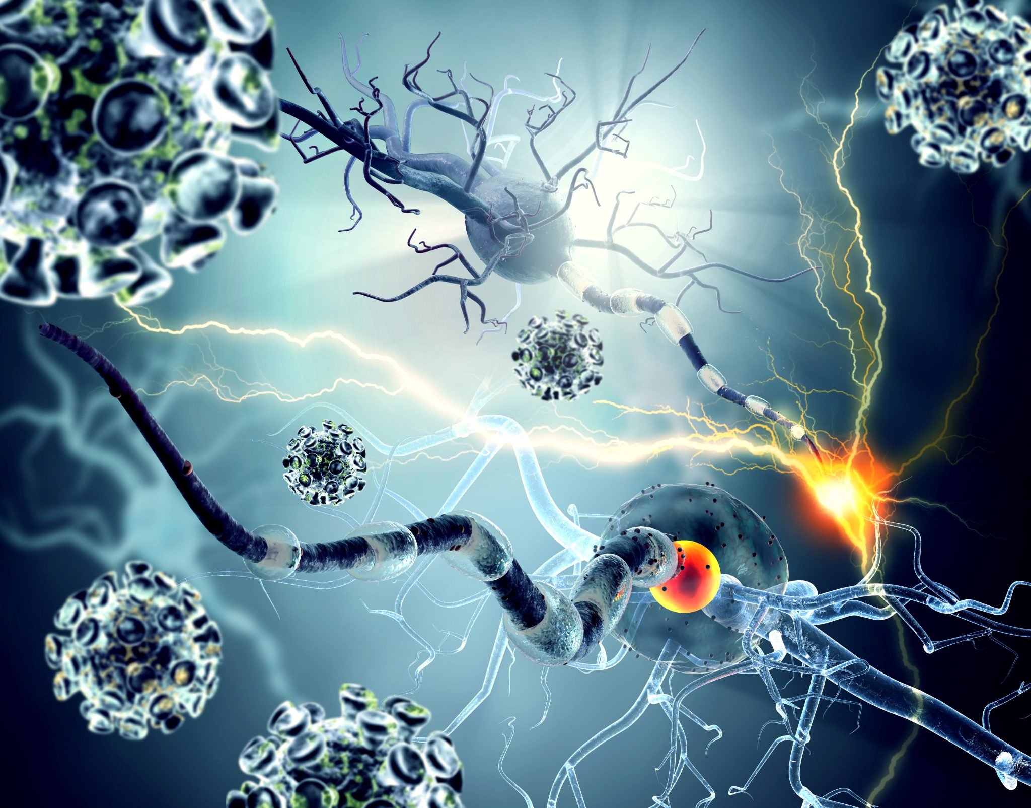 Which Types Of Accidents Can Lead To Permanent Nerve Damage Merkel 