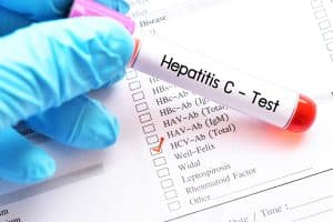 All Pregnant Women Must Be Tested for Hepatitis C